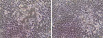 Cytopathic effects of highly pathogenic avian influenza A (H5N1) virus in Vero cells isolated from fetal bovine serum, United States, 2025. Vero cells inoculated with non–heat-inactivated fetal bovine serum sample (046093-25-2) show cell rounding and vacuolation on day 7 of incubation. Images represent different fields of view of the same cell culture on the same day (original magnification × 20).