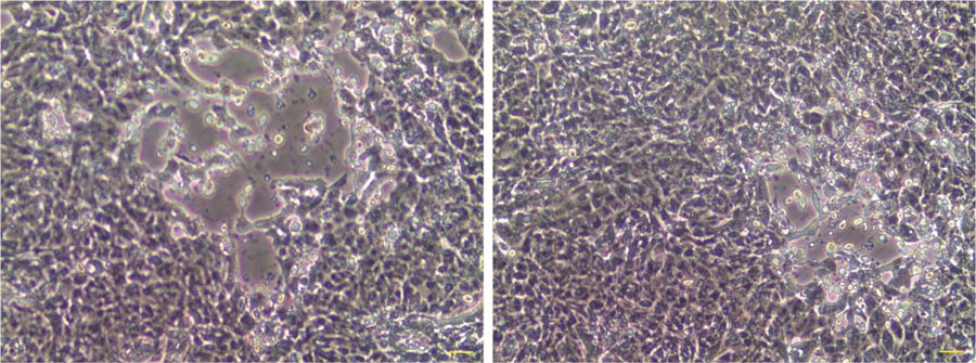 Cytopathic effects of highly pathogenic avian influenza A (H5N1) virus in Vero cells isolated from fetal bovine serum, United States, 2025. Vero cells inoculated with non–heat-inactivated fetal bovine serum sample (046093-25-2) show cell rounding and vacuolation on day 7 of incubation. Images represent different fields of view of the same cell culture on the same day (original magnification × 20).