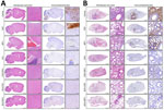 Lung and brain histopathology and influenza A nucleoprotein immunoreactivity at 6 dpi after monotherapy or combination therapy in a study of treating influenza A(H5N1) clade 2.3.4.4b virus infection in mice. A) Brain sections; B) lung sections. Sections from vehicle, OSP, MPV, BXA, OSP/MPV, BXA/OSP, and BXA/MPV groups. For each group, representative hematoxylin and eosin images (left) and immunohistochemistry for influenza A nucleoprotein (right; 3,3′-diaminobenzidine with hematoxylin counterstain) are shown as whole-section views with corresponding higher-magnification insets (boxed regions). Scale bars indicate 1.25 mm for whole-section views; and 100 μm for higher-magnification insets. BXA, baloxavir acid; MPV, molnupiravir; OSP, oseltamivir phosphate.