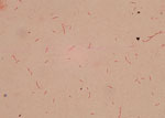 Gram stain of isolate from case 2 in report of 2 cases of Caballeronia bacteremia in children with cancer, United States. Staining shows a gram-negative bacillus in pairs and chains with tapered ends and possible endospores. Original magnification ×100.