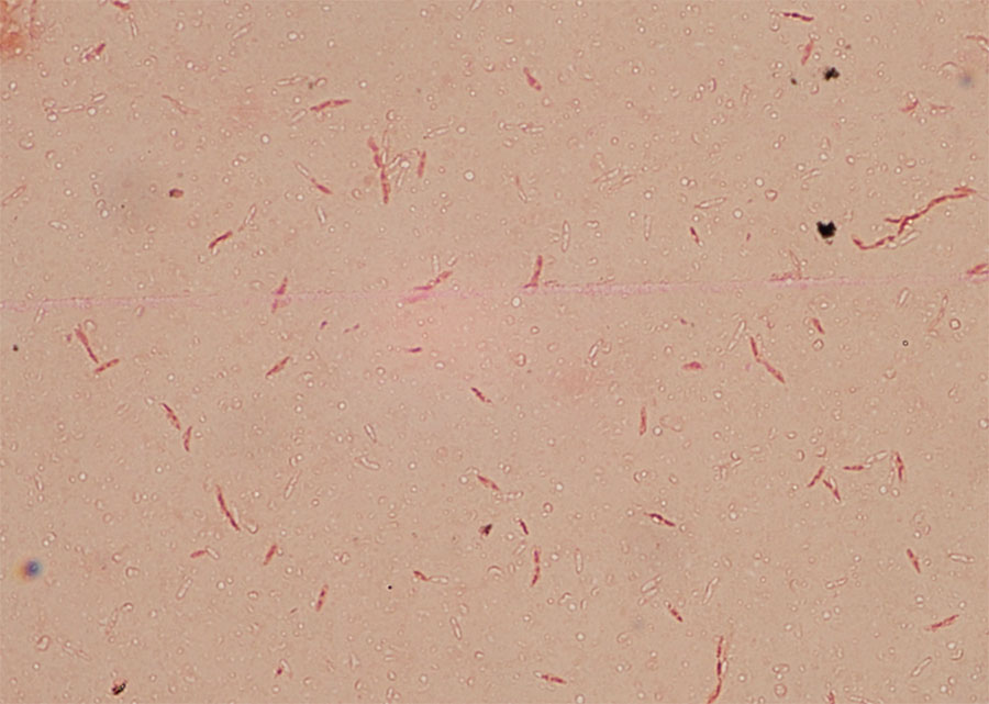 Gram stain of isolate from case 2 in report of 2 cases of Caballeronia bacteremia in children with cancer, United States. Staining shows a gram-negative bacillus in pairs and chains with tapered ends and possible endospores. Original magnification ×100.