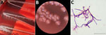 Results of sample testing in cluster of suspected sexual transmission of dermatophilosis among men who have sex with men, Lyon and Paris, France, 2025–2026. A, B) Dermatophilus congolensis colonies obtained on blood agar after 40 hours of incubation, seen with the naked eye (A) and by stereomicroscope (B). C) Microscopic examination of D. congolensis isolated from patient 1 skin sample. Gram staining; scale bar indicates 25 μm.