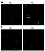 Confocal laser scanning microscopy of Klebsiella pneumoniae carbapenemase (KPC)–producing K. pneumoniae with penicillin-binding protein 3 (PBP3) insertions with and without ATM treatment, Taiwan, 2021. Isolates on the left (ATM–) were not treated with aztreonam and isolates on the right (ATM+) were treated with 64 µg/mL ATM for 6 hours. A) KPC-producing K. pneumoniae with wild-type PBP3 showing elongated and filamentous PBP3 in ATM+, a typical feature of PBP3 inhibition. Isolate used (isolate no. LC6990) was collected from the same hospital as patient isolate in this study (B) and had similar sequence type 11, K locus 47, KPC-2–producing background, and aztreonam MIC (>128 µg/mL). B) KPC-producing K. pneumoniae with PBP3 insertion mutations from isolate LC1491 from this study. Note that ATM+ does not show PBP3 inhibition (filamentation) under the conditions of this experiment. Images were acquired using a 63× objective. ATM, aztreonam.