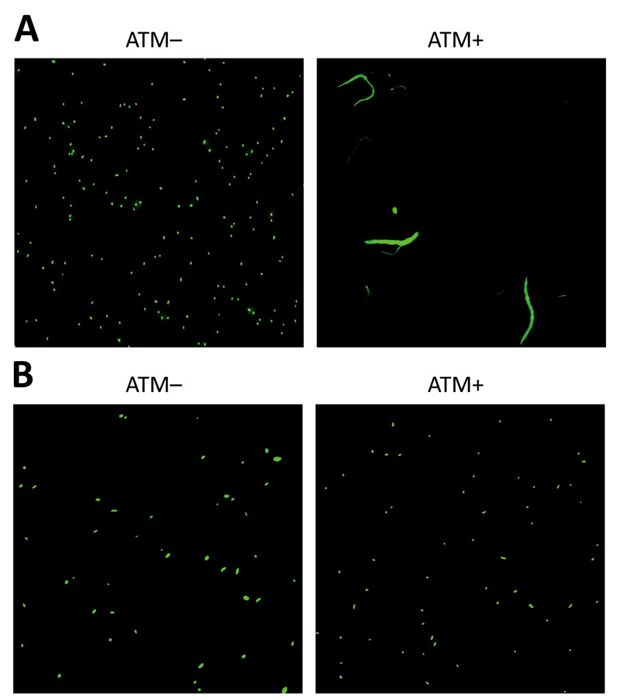 Confocal laser scanning microscopy of Klebsiella pneumoniae carbapenemase (KPC)–producing K. pneumoniae with penicillin-binding protein 3 (PBP3) insertions with and without ATM treatment, Taiwan, 2021. Isolates on the left (ATM–) were not treated with aztreonam and isolates on the right (ATM+) were treated with 64 µg/mL ATM for 6 hours. A) KPC-producing K. pneumoniae with wild-type PBP3 showing elongated and filamentous PBP3 in ATM+, a typical feature of PBP3 inhibition. Isolate used (isolate no. LC6990) was collected from the same hospital as patient isolate in this study (B) and had similar sequence type 11, K locus 47, KPC-2–producing background, and aztreonam MIC (>128 µg/mL). B) KPC-producing K. pneumoniae with PBP3 insertion mutations from isolate LC1491 from this study. Note that ATM+ does not show PBP3 inhibition (filamentation) under the conditions of this experiment. Images were acquired using a 63× objective. ATM, aztreonam.