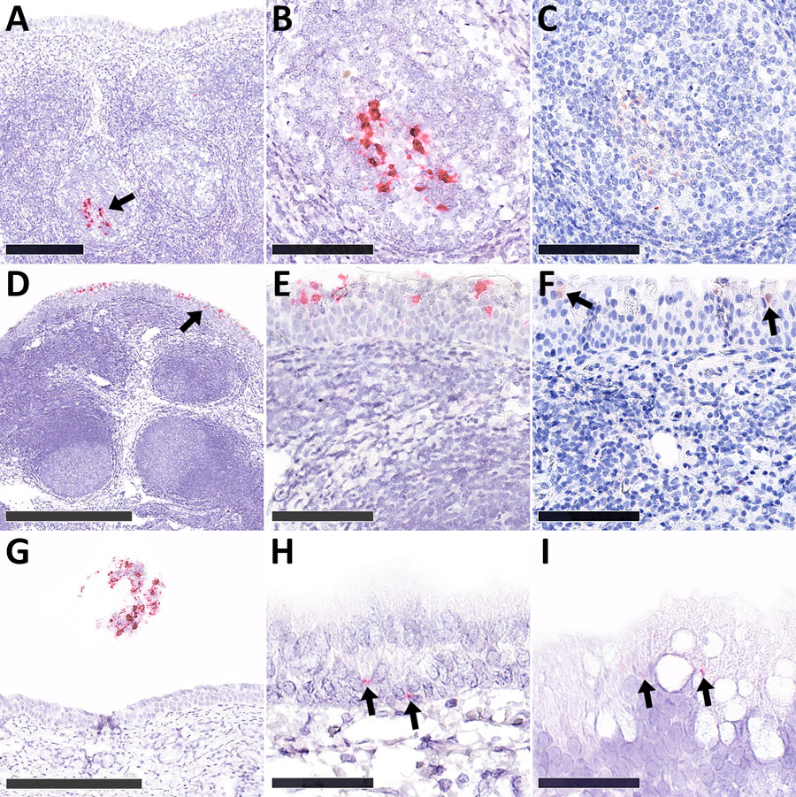 Histopathologic detection in nasopharyngeal tonsil and nasal conchae from experimental highly pathogenic avian influenza A(H5N1) clade 2.3.4.4b virus infection in alpacas, 2026. In situ hybridization (ISH) performed by using Fast Red chromogen; immunohistochemistry (IHC) performed by using 3-amino-9-ethylcarbazole substrate for red-brown chromogen; Mayer’s hematoxylin counterstain used for both ISH and IHC. A, B) ISH showing strong cytoplasmic RNA labeling (arrow in A [scale bar indicates 250 µm], detail in B [scale bar indicates 100 µm]) from nasopharyngeal tonsil of alpaca 3. C) IHC of nasopharyngeal tonsil from alpaca 3 showing weak antigen signals within follicular macrophages and dendritic cells; scale bar indicates 100 µm. D–F) Tonsillar epithelium from alpaca 2. D, E) ISH showing viral RNA (arrow in D [scale bar indicates 250 µm], detail in E [scale bar indicates 100 µm]); F) IHC showing antigen (arrows) in the nucleus and cytoplasm. Scale bar indicates 100 µm. G–I) ISH showing abundant detection of viral RNA within cellular debris on left cranial nasal cavity tissue from alpaca 1 (G; scale bar indicates 250 µm), nasal epithelium of alpaca 1 at 4 days postinfection (H), and alpaca 4 at 20 days postinfection (I) (arrows). Scale bars indicate 50 µm.