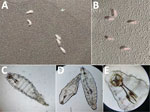 Morphologic identification of Oestrus ovis larvae extracted from patients with acute external ophthalmomyiasis after sheep exposure during Eid al-Adha, Algeria, 2025. A, B) Extracted first-instar larva from the ocular surface is shown grossly. C–E) Microscopic examination demonstrates characteristic features of O. ovis, including prominent oral hooks connected to the internal cephalopharyngeal skeleton and multiple rows of spiny projections. Original magnification ×40 (panel C), ×10 (panel D), and ×100 (panel E).