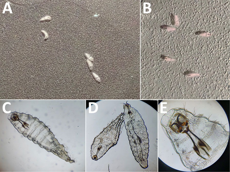 Morphologic identification of Oestrus ovis larvae extracted from patients with acute external ophthalmomyiasis after sheep exposure during Eid al-Adha, Algeria, 2025. A, B) Extracted first-instar larva from the ocular surface is shown grossly. C–E) Microscopic examination demonstrates characteristic features of O. ovis, including prominent oral hooks connected to the internal cephalopharyngeal skeleton and multiple rows of spiny projections. Original magnification ×40 (panel C), ×10 (panel D), and ×100 (panel E).