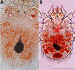 Comparison of engorged larval mites from a study of reemergence of scrub typhus associated with Leptotrombidium akamushi mites and Karp-like Orientia tsutsugamushi genotype bacteria, Japan, 2024–2025. A) L. akamushi larva; B) semi-engorged L. pallidum larva. Larvae were collected from field mice in Niigata Prefecture at the site of probable patient O. tsutsugamushi infection. L. akamushi can be distinguished from L. pallidum by the position of the sensillary setae (black arrows), which arise anterior to the posterolateral setae of the scutum, and by the presence of 8 dorsal idiosomal setae in a transverse row (white arrows). Those morphological characteristics were consistent with the molecular identification on the basis of COX1 sequence analysis. Scale bar indicates 100 μm; both images are at the same magnification.