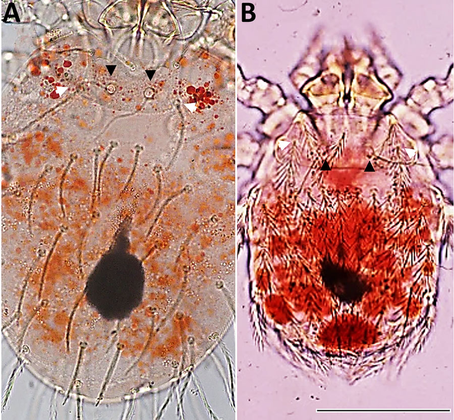 Comparison of engorged larval mites from a study of reemergence of scrub typhus associated with Leptotrombidium akamushi mites and Karp-like Orientia tsutsugamushi genotype bacteria, Japan, 2024–2025. A) L. akamushi larva; B) semi-engorged L. pallidum larva. Larvae were collected from field mice in Niigata Prefecture at the site of probable patient O. tsutsugamushi infection. L. akamushi can be distinguished from L. pallidum by the position of the sensillary setae (black arrows), which arise anterior to the posterolateral setae of the scutum, and by the presence of 8 dorsal idiosomal setae in a transverse row (white arrows). Those morphological characteristics were consistent with the molecular identification on the basis of COX1 sequence analysis. Scale bar indicates 100 μm; both images are at the same magnification.