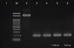 Electrophoretic analysis of bepA-specific PCR amplicons in study of persistent Bartonella quintana infection in macaques at primate research institute, Japan. Lane M, 0.1–2 kb DNA size marker; lane 1, nuclease-free water (negative control); lane 2, Bartonella quintana strain FullerT (positive control); lane 3, strain MF1-1; lane 4, strain TB1-1; lane 5, strain MN51-1; lane 6, strain MN57-1. The expected amplicon size for the bepA locus is 1,612 bp, as observed in the positive control (lane 2). As with strain MF1-1 (lane 3), amplicon size of strains TB1-1, MN51-1, and MN57-1 (lanes 4–6) was ≈200 bp, indicating the absence of the bepA locus in the chromosome.