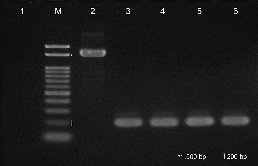 Electrophoretic analysis of bepA-specific PCR amplicons in study of persistent Bartonella quintana infection in macaques at primate research institute, Japan. Lane M, 0.1–2 kb DNA size marker; lane 1, nuclease-free water (negative control); lane 2, Bartonella quintana strain FullerT (positive control); lane 3, strain MF1-1; lane 4, strain TB1-1; lane 5, strain MN51-1; lane 6, strain MN57-1. The expected amplicon size for the bepA locus is 1,612 bp, as observed in the positive control (lane 2). As with strain MF1-1 (lane 3), amplicon size of strains TB1-1, MN51-1, and MN57-1 (lanes 4–6) was ≈200 bp, indicating the absence of the bepA locus in the chromosome.