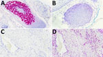 In situ hybridization (RNAscope) (5) for trichodysplasia spinulosa polyomavirus (TSPyV) in tissue samples, United States. A) Positive control tissue from a case of trichodysplasia spinulosa with staining for TSPyV. Original magnification ×200. B) peptidylprolyl isomerase B (PPIB) RNA probe staining on the same control tissue. Original magnification ×400. C) A representative case of inflammatory dermatosis with no staining for TSPyV RNA. Original magnification ×200. D) PPIB RNA probe staining on the same tissue in (C). Original magnification ×200.