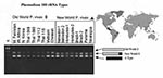 Thumbnail of Sequences of Plasmodium vivax isolates are distinguished by variation in the 3' end of the S-type rRNA gene (10). The S-type gene is longer in Old World isolates and in P. simium. Oligonucleotide #902 (5'CAGCAAGCTGAATCGTAATTTTAA3') was used to detect type A rRNA, and #743 (5'ATCCAGATCCAATCCGACATA3') and #901 (5'GATAAGCACAAAATAGCGAAATGC3') were used to differentiate the two S-type rRNAs in membrane blot hybridization. American Type Culture Collection reference numbers not designated
