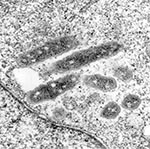 Thumbnail of Transmission electron micrograph of the ELB agent in XTC-2 cells. The rickettsia are free in the cytoplasm and surrounded by an electron transparent halo. Original magnification X 30,000.