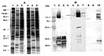 Thumbnail of (A) Silver-stained SDS-PAGE of whole-cell protein preparations of Rickettsia conorii, the ELB agent and R. typhi. Lane 1, R. conorii; lane 2. ELB agent; lane 3, R. typhi; lane 4, heated R. conorii; lane 5, heated ELB agent; lane 6, heated R. typhi. Molecular weights are indicated on the left. (B) Western blot of rickettsial proteins probed with various antisera. R. conorii antigens (lanes 2, 6, and 10), ELB agent antigens (lanes 3, 7, and 11) and R. typhi antigens (lanes 4, 8, and 1