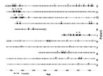 Thumbnail of Persistence and variability of Stenotrophomonas maltophilia strains in 11 patients with repeated episodes of infection or colonization with this organism. S. maltophilia recovered is indicated by a ◆(identical isolates from the same patient), ◇(different isolate from a single patient) or O (no isolate available). Distinct S. maltophilia isolates are identified by numbers, and a letter was added when a closely related strain was observed. + = time at which sputum specimens were obtai