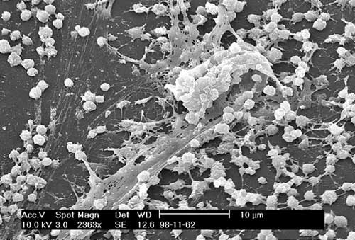 Scanning electron micrograph of a Staphylococcus biofilm on the inner surface of a needleless connector. Photograph by Janice Carr, Centers for Disease Control and Prevention, Atlanta, GA USA.