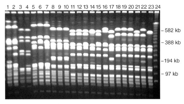 Pulsed-field gel electrophoresis (PFGE) profiles of Staphylococcus aureus isolates digested with Sma 1. A variety of PFGE profiles are demonstrated in these 23 isolates.