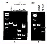 Thumbnail of A. Three distinct A1uI digestion patterns of PCR amplified protease gene representing single HIV-1 infections by viral strains of subtypes A, C, F (pattern #1), and subtypes B and D (patterns #2 and #3). B. The presence of two distinct A1uI digestion patterns (#1 and #2) of the protease gene in PBMC of the patient dually infected by viral strains of subtypes F and B (lane 3). Arrows indicate diagnostic fragments deteted by hybridization with the radioactive probe (2). MW represents 