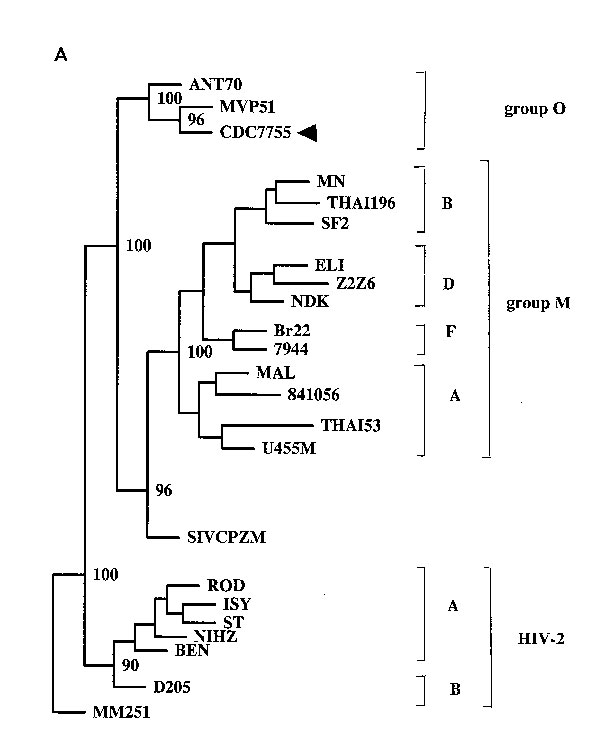 Phylogenetic analysis of the prt and env gene sequences. The patient's isolate is indicated by the arrow. The trees were constructed on the basis of the proviral DNA sequences for the protease gene (A) by the neighbor-joining method in the Phylip 3.5c package (2) and 230 aligned nucleotides from the C2V3 region of the env gene of Group O isolates (B) by using the maximum likelihood method with the fast DNAml program (1). Numbers at the branch nodes within the protease tree indicate bootstrap val