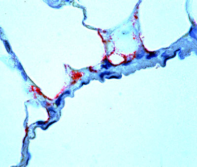 Ebola virus antigen-positive cells (red) in lung of an insectivorous bat as determined by immunohistochemistry. Note prominent endothelial immunostaining. (Rabbit anti-Ebola virus serum, napthol/fast red with hematoxylin counterstain, original magnification x 250).