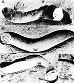 Thumbnail of   Freeze-fracture electron microscopy of T. pallidum subsp. pallidum demonstrating TROMP aggregation. Concave  and convex   outer membrane fracture faces (OM). T. pallidum incubated in heat-inactivated normal rabbit serum for 16 hours (A), in immune rabbit serum for 2 hours (B), and in immune rabbit serum for 16 hours (C) and (D). Arrows show individual (A&amp;B) and aggregated (C&amp;D) TROMPs. Bar in each micrograph represents 0.1mm. Photograph reprinted with the permission of the