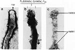 Thumbnail of Transmission electron photomicrographs of the specialized tip organelle of cytadherence-positive M. pneumoniae demonstrating a) truncated structure with nap, b) clustering of cytadherence-related proteins (P1, B, C, P30) at the tip based on immunolabeling with ferritin and colloidal gold and crosslinking studies, and c) Triton X-100-resistant, cytoskeleton-like, structure with distinct bleb and parallel filaments (14,43,45,46).