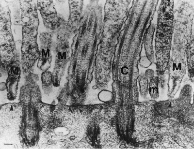 Transmission electron photomicrograph of a hamster trachea ring infected with M. pneumoniae (43). Note the orientation of the mycoplasmas through their specialized tiplike organelle, which permits close association with the respiratory epithelium. M, mycoplasma; m, microvillus; C, cilia.