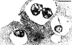Thumbnail of Piscirickettsia salmonis within a cytoplasmic vacuole in CHSE-214 cell line 4 days post inoculation. Note organisms dividing within vacuole. May Greenwald-Giemsa stain. Bar = 1 µm.