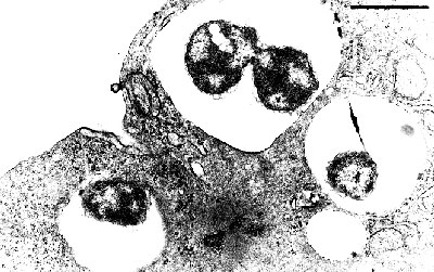 Piscirickettsia salmonis within a cytoplasmic vacuole in CHSE-214 cell line 4 days post inoculation. Note organisms dividing within vacuole. May Greenwald-Giemsa stain. Bar = 1 µm.