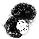 Thumbnail of Piscirickettsia salmonis undergoing apparent binary fission within a vacuole in the cytoplasm of infected CHSE-214 cells. Bar = 10 µm.