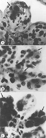 Thumbnail of Comparison of morphology and tinctorial properties of Feulgen stained, intact tick salivary glands infected by three of the deer tick pathogen guild. Spirochetes only transiently migrate through salivary tissues, and thus would not be visualized by this technique. (A) Ehrlichia microti. Polyhedral clusters of rickettsiae (arrows) within hypertrophied salivary acinus. (B) Babesia microti, dense stippling of sporoblasts (arrows). Each minute dot represents the nucleus of a sporozoite.