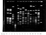 Thumbnail of Pulsed field gel electrophoresis of Haemophilus influenzae type b (Hib) isolates from blood culture of two elderly nursing home residents (lanes 1 and 2) compared with epidemiologically unrelated H. influenzae isolates sent to our laboratory for typing: lane 3, laboratory Hib strain; lane 4, non-H. influenzae; lane 5 and 12, invasive nontypeable H. influenzae; lane 6-11, unrelated Hib isolates; lane 13, H. influenzae type a; lane 14, 1 kilobase molecular marker. The enzyme used for