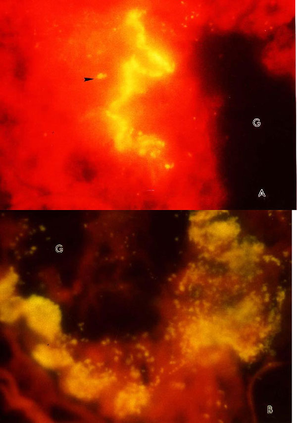 Direct fluorescent staining of the frozen sections of midguts of X. cheopis fleas showing R. typhi-infected epithelial cells at 3 (A) and 10 days (B) postinfectious feeding. Fleas were embedded individually in OCT compound (Miles Laboratories, Naperville, IL), sectioned (4-6 m)(16), and stained with fluorescein isothiocyanate (FITC)-labeled guinea pig anti-R. typhi IgG. G: gut lumen.