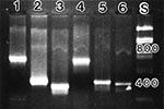 Thumbnail of Amplicons for various flea-borne bacterial pathogens. Lane 1: R. typhi 16SrRNA (600bp); Lane 2: R. felis 17 kDa (434bp); Lane 3: R. typhi citrate synthase(384bp); Lane 4: R. typhi 120 kDa (612bp); Lane 5: B. henselae 60 kDa (414bp); Lane 6: flea 12SrRNA (414bp); and Lane S: DNA standards, with 400 and 800bp sizes indicated.