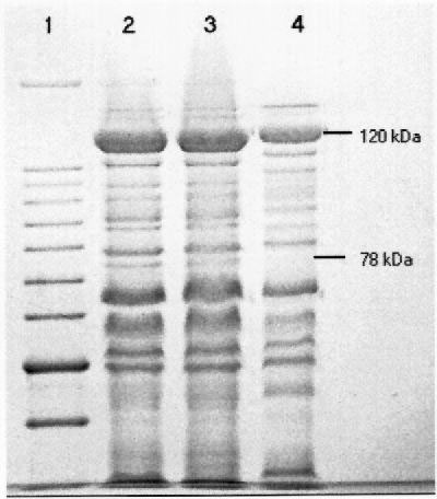 Coomassie blue stained polypeptide profiles of the R. felis, R. typhi, and R. akari plaque-purified seeds separated by SDS-PAGE (7.5%). Lane 1: 10kDa molecular mass marker, with 78 and 120kDa sizes indicated; Lane 2: R. felis; Lane 3: R. typhi (Wilmington); and Lane 4: R. akari (Kaplan).