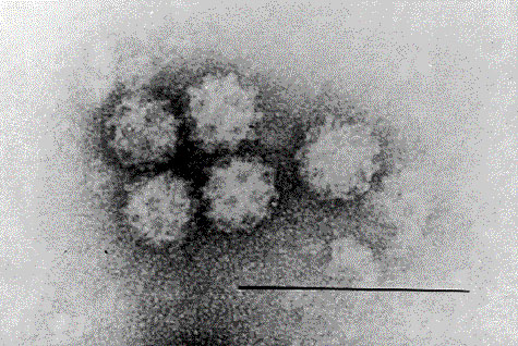 Electron photomicrograph of Cetacean Calicivirus Tursiops - 1 (CCVTur-1). Negative staining using phosphotungstic acid on a carbon-coated grid showing typical surface cup morphologic features as commonly seen by electron microscopy. Bar = 100 nm.