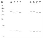 Thumbnail of Prior to alignment of two sets of 2-banders, lanes are difficult to cluster (lanes a-d are from the distributions in Figure 4a and b). Subsequent to alignment, lanes are much easier to cluster (lanes a' and b' are specific examples from the distributions in Figure 4e and ff; lanes c' and d' likewise correspond to Figure 4g and h). Fragment lengths are given in kilobasepairs (kb).