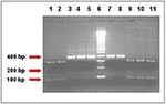 Thumbnail of Human- and bovine-specific restriction enzymes showed distinct banding pattern for genotypes of Cryptosporidium parvum isolates. The different lanes represent the TRAP-C2 PCR-amplified products belonging to AGA43, AMD36, AOH6, HM3, and HM5 isolates of C. parvum, respectively, after digestion with HaeIII (Lanes 1-5, human-specific marker) and BstE II (Lanes 7-11, bovine-specific marker) restriction enzymes and agarose gel electrophoresis. Lane 6 is the 100 bp marker. Samples AGA43, A