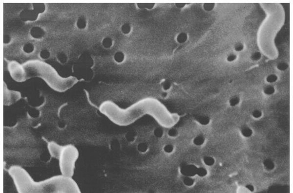 Scanning electron microscope image of Campylobacter jejuni, illustrating its corkscrew appearance and bipolar flagella. Source: Virginia-Maryland Regional College of Veterinary Medicine, Blacksburg, Virginia.