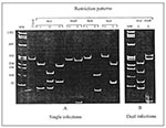 Thumbnail of Differentiation between single (A) and dual (B) HIV-1 infections by the restriction fragment length polymorphism analysis of the polymerase chain reaction—amplified prt. A: Three AluI digestion patterns represent subtypes A, C, and F (pattern 1) and subtypes B and D (patterns 2 and 3); two HinfI patterns represent subtypes D (pattern 1) and B (pattern 2); two BclI patterns represent subtypes F (patterns 1) and A and C (pattern 2); two ScaI patterns represent subtypes A (pattern 1) a