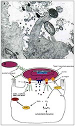 Thumbnail of A. Transmission electron micrograph of an A/E lesion formed by rabbit enteropathogenic Escherichia coli (EPEC) infecting rabbit intestinal epithelial cells (micrograph provided by Dr. Ursula Heczko, Biotechnology Laboratory, University of British Columbia). B. Effects of EPEC infection on host intestinal epithelial cells. EPEC initially adheres to the host cell by its bundle-forming pili, which also mediate bacterial aggregation. Following initial attachment, EPEC secretes several v