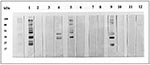 Thumbnail of Western blot of Toxoplasma gondii or Neospora caninum antigen. Analysis was performed essentially as described by Sharma et al. (12) by using tachyzoites from in vitro culture of the N. caninum NC-1 isolate (13) and the T. gondii RH strain (10). Lanes 1-4 were probed with control sera and lanes 5-12 with human sera with high absorbencies in the N. caninum enzyme-linked immunosorbent assay.  Lane 1: T. gondii-positive human serum and T. gondii antigen; Lane 2: N. caninum-positive pig
