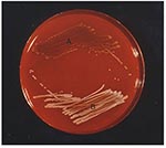 Thumbnail of Staphylococcus aureus small colony variants (A) and S. aureus with a normal phenotype (B) cultured on sheep blood agar after 24 hours of incubation at 35°C. Staphylococci were identified by conventional methods (6) and with the ID 32 Staph system (bioMérieux, Marcy-L'Etoile, France) following the instructions of the manufacturer. The tube-coagulase test was read after 24 hours. S. aureus isolates were characterized as small colony variants as described before (7-8). Auxotrophic requ