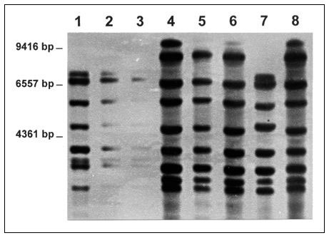 Ribosomal RNA gene restriction patterns obtained by using restriction enzyme Pvu II of Corynebacterium diphtheriae isolates belonging to ribotypes B (lanes 1 to 3), A (lanes 4 to 6 and 8), and C (lane 7).