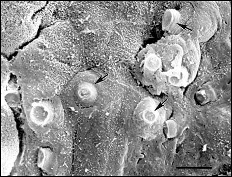 Scanning electron micrograph of digital skin of a wild frog (Litoria lesueuri, from Queensland, Australia) that died of cutaneous chytridiomycosis. Many cells within this area of the superficial layer of the epidermis contain mature sporangia, and unopened discharge tubes are visible protruding through infected cells. The skin was fixed in 2.5% glutaraldehyde, postfixed in 1% osmium tetroxide, dehydrated, critical-point-dried, sputter coated with gold, and examined with a JEOL JSM 840 scanning e