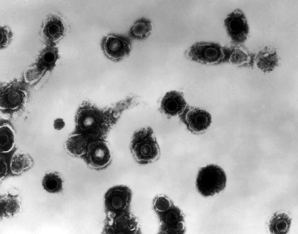 Legend: Electron micrograph showing varicella zoster virus (VZV).