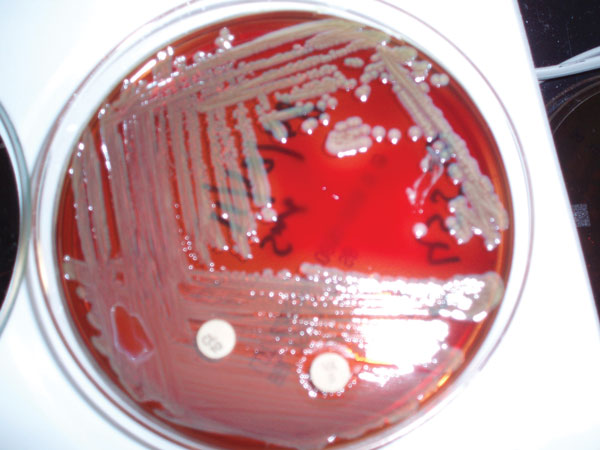 Six-day-old blood agar growth of Elizabethkingia meningioseptica with 5 μg vancomycin (with zone of clearing) and 10 μg colistin disks. Source: Dr. Saptarshi via Wikimedia Commons