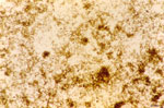 Thumbnail of Hemozoin