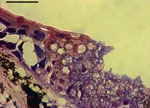 Thumbnail of Basal infection in the skin of a fire salamander (Salamandra salamandra), characterized by extensive epidermal necrosis, presence of high numbers of intra-epithelial colonial chytrid thalli, and loss of epithelial integrity. Photo by A. Martel and F. Pasmans, courtesy Wikipedia.